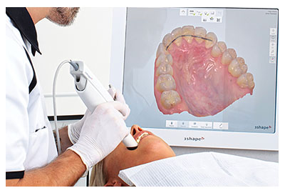 Escáner intraoral