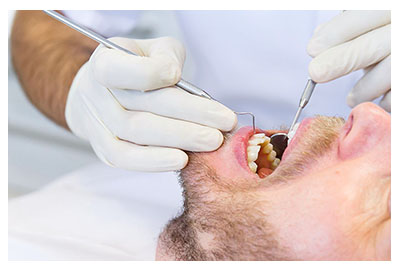 Tratamiento de la gingivitis